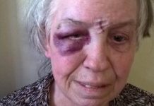 COUNTY NEWS: Woman with autism beaten by robber for £11